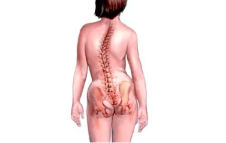 Las razones para el desarrollo de la osteocondrosis del cuello uterino