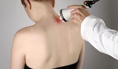Tratamiento del dolor en la garganta Procedimiento fisioterapéutico