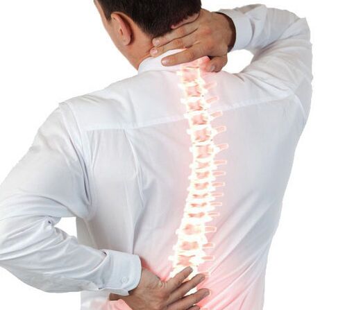 Osteocondrosis de la columna en un hombre.